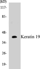 Keratin 19 Colorimetric Cell-Based ELISA Kit