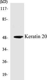 Keratin 20 Colorimetric Cell-Based ELISA Kit