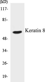 Keratin 8 Colorimetric Cell-Based ELISA Kit
