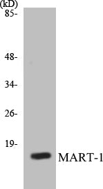 MART-1 Colorimetric Cell-Based ELISA Kit