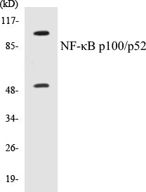 NF-κB p100/p52 Colorimetric Cell-Based ELISA Kit