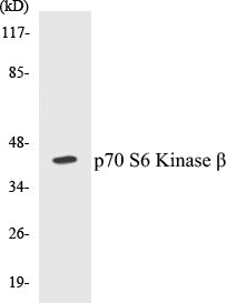 p70 S6 Kinase beta Colorimetric Cell-Based ELISA Kit