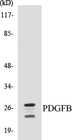 PDGFB Colorimetric Cell-Based ELISA Kit