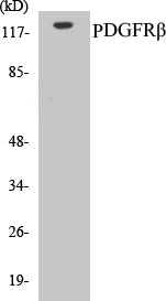 PDGFRbeta Colorimetric Cell-Based ELISA Kit