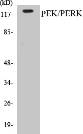 PEK/PERK Colorimetric Cell-Based ELISA Kit