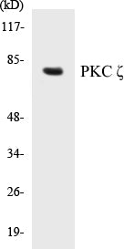 PKC zeta Colorimetric Cell-Based ELISA Kit