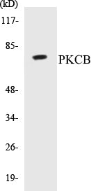 PKCB Colorimetric Cell-Based ELISA Kit