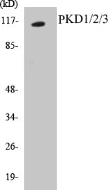 PKD1/2/3 Colorimetric Cell-Based ELISA Kit