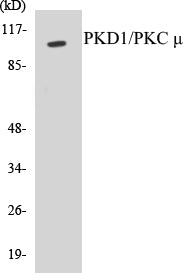 PKD1/PKC mu Colorimetric Cell-Based ELISA Kit