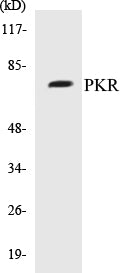 PKR Colorimetric Cell-Based ELISA Kit