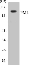 PML Colorimetric Cell-Based ELISA Kit