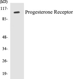 Progesterone Receptor Colorimetric Cell-Based ELISA Kit
