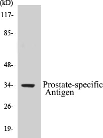 Prostate-specific Antigen Colorimetric Cell-Based ELISA Kit