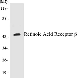 Retinoic Acid Receptor beta Colorimetric Cell-Based ELISA Kit