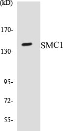 SMC1 Colorimetric Cell-Based ELISA Kit