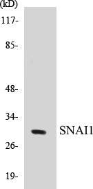 SNAI1 Colorimetric Cell-Based ELISA Kit