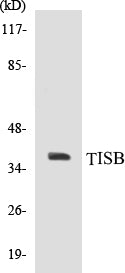 TISB Colorimetric Cell-Based ELISA Kit
