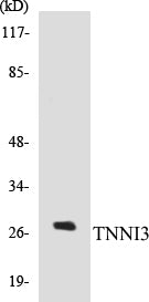 TNNI3 Colorimetric Cell-Based ELISA Kit