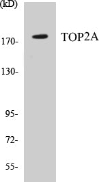 TOP2A Colorimetric Cell-Based ELISA Kit