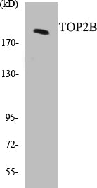 TOP2B Colorimetric Cell-Based ELISA Kit