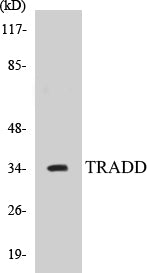 TRADD Colorimetric Cell-Based ELISA Kit