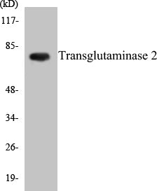Transglutaminase 2 Colorimetric Cell-Based ELISA Kit