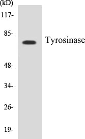 Tyrosinase Colorimetric Cell-Based ELISA Kit