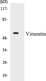 Vimentin Colorimetric Cell-Based ELISA Kit