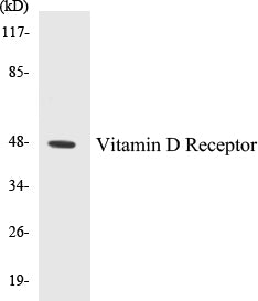 Vitamin D Receptor Colorimetric Cell-Based ELISA Kit