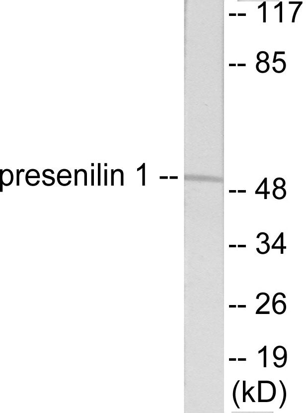 Presenilin 1 Colorimetric Cell-Based ELISA