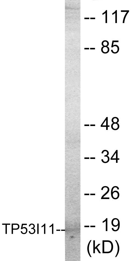 TP53I11 Colorimetric Cell-Based ELISA