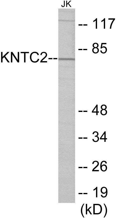 KNTC2 Colorimetric Cell-Based ELISA