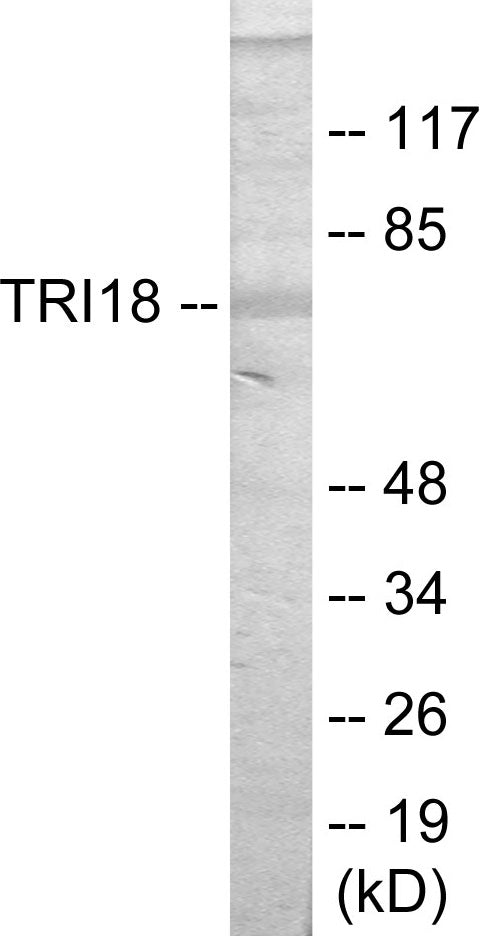TRI18 Colorimetric Cell-Based ELISA