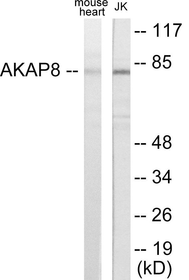 AKAP8 Colorimetric Cell-Based ELISA