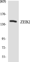 ZEB2 Colorimetric Cell-Based ELISA