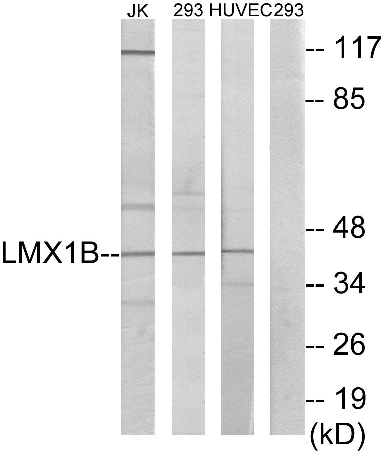 LMX1B Colorimetric Cell-Based ELISA
