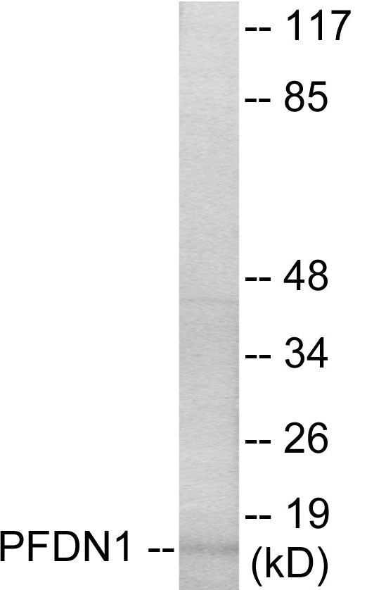 PFDN1 Colorimetric Cell-Based ELISA