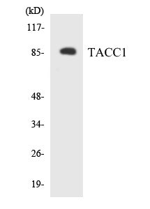 TACC1 Colorimetric Cell-Based ELISA