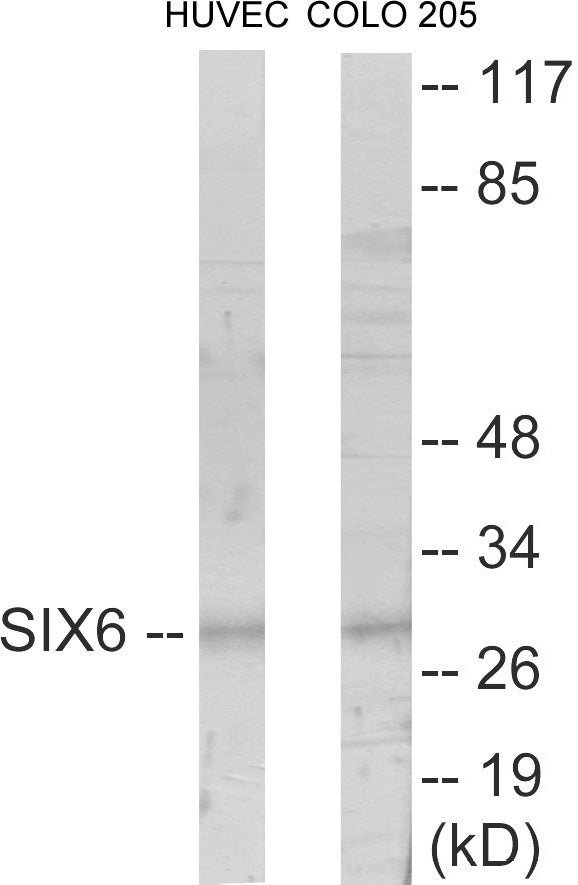 SIX6 Colorimetric Cell-Based ELISA