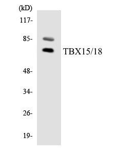 TBX15/18 Colorimetric Cell-Based ELISA