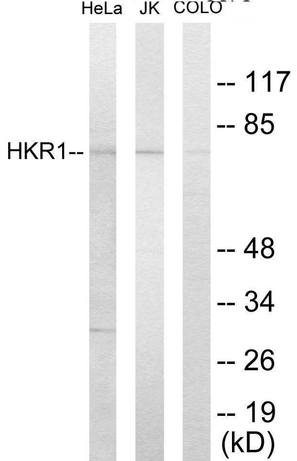 HKR1 Colorimetric Cell-Based ELISA