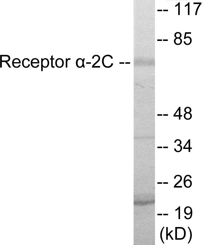 Adrenergic Receptor alpha-2C Colorimetric Cell-Based ELISA