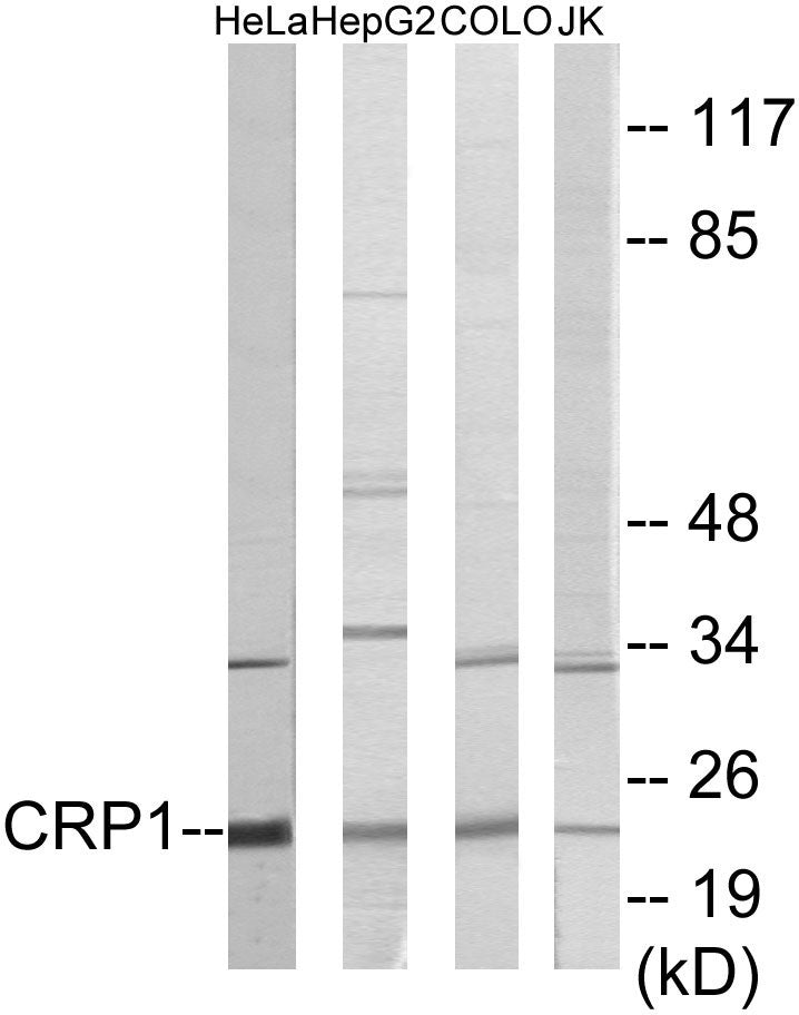 CRP1 Colorimetric Cell-Based ELISA