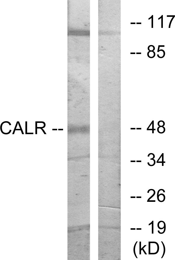 CALR Colorimetric Cell-Based ELISA