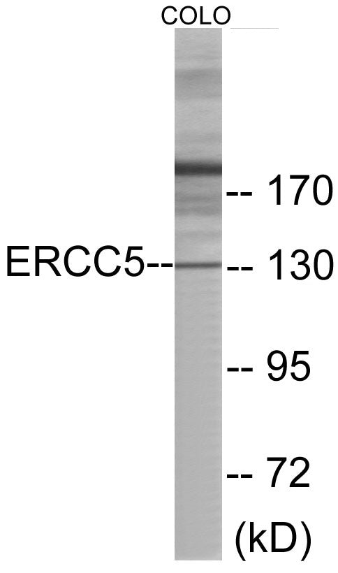 ERCC5 Colorimetric Cell-Based ELISA