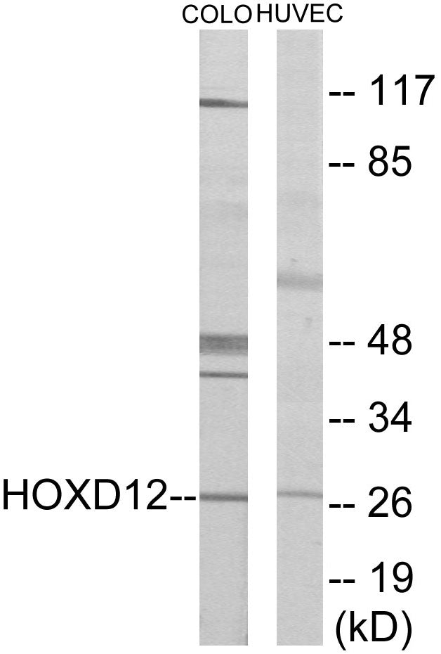 HOXD12 Colorimetric Cell-Based ELISA