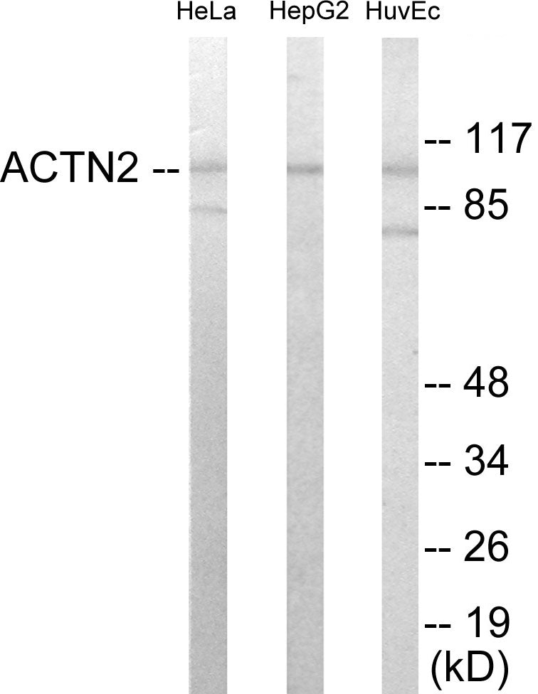 Actinin alpha-2/3 Colorimetric Cell-Based ELISA
