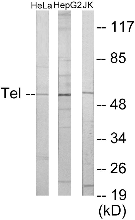 ETV6 Colorimetric Cell-Based ELISA