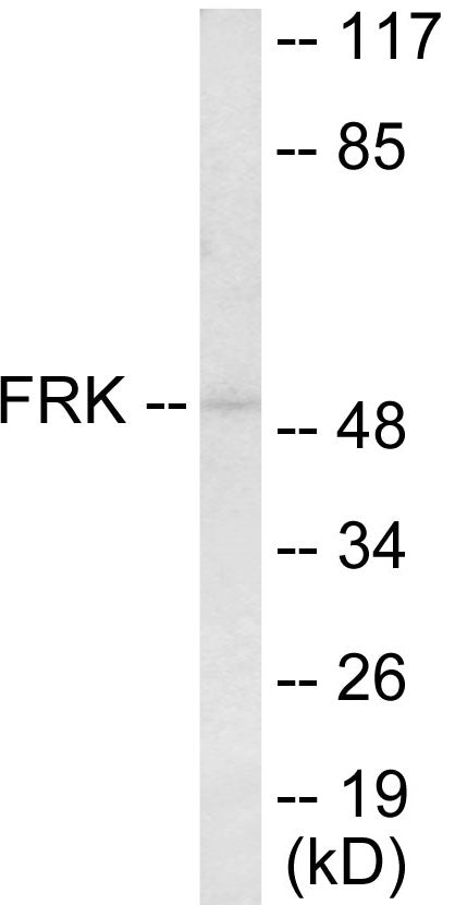 FRK Colorimetric Cell-Based ELISA
