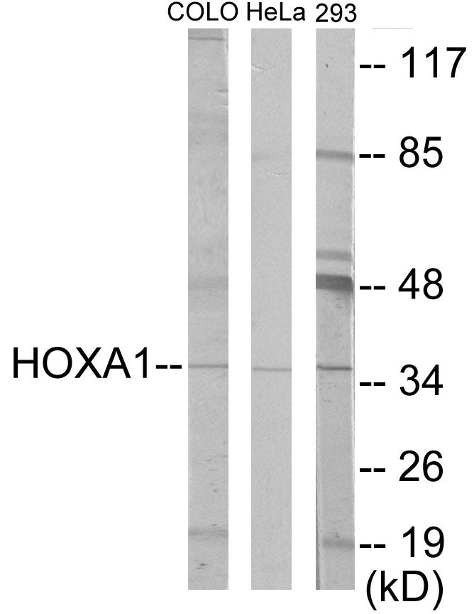 HOXA1 Colorimetric Cell-Based ELISA